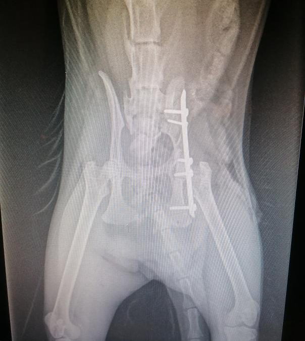 L’orthopédie