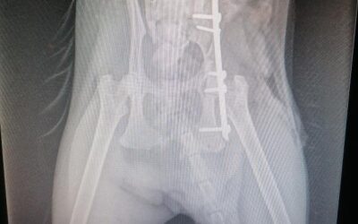 L’orthopédie