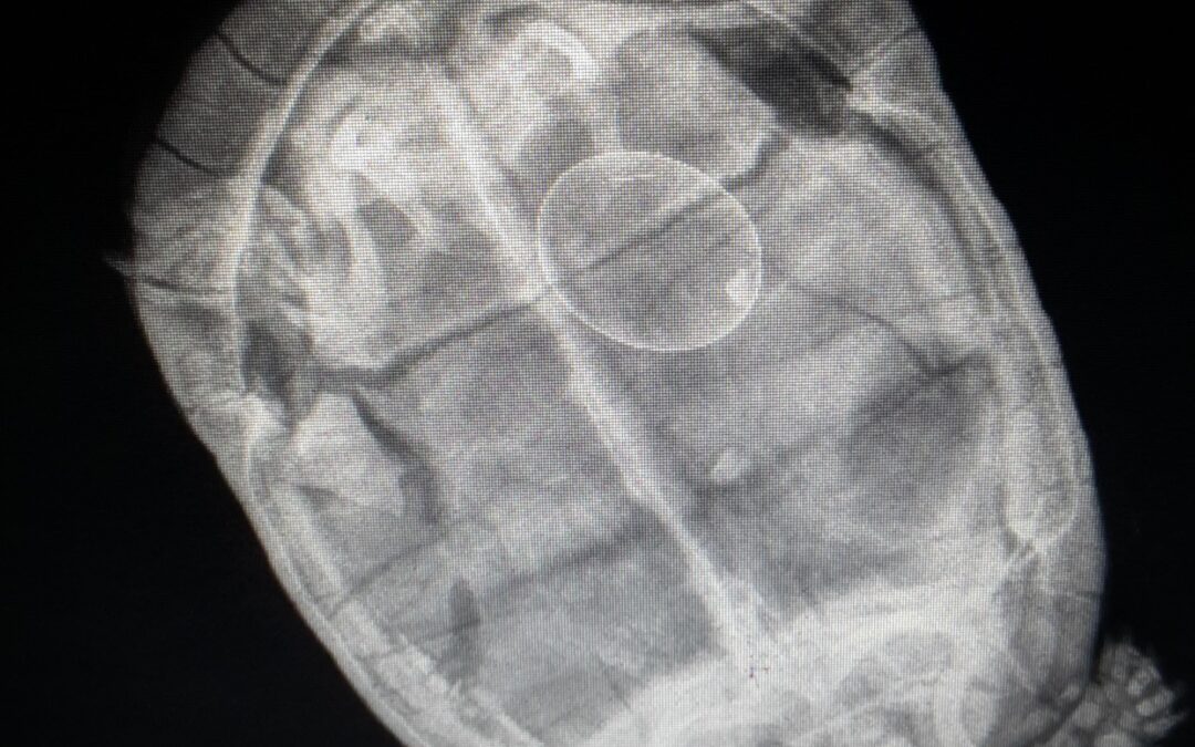 Imagerie médicale